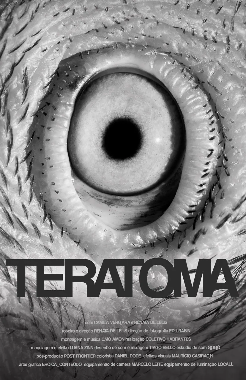 TERATOMA — 5